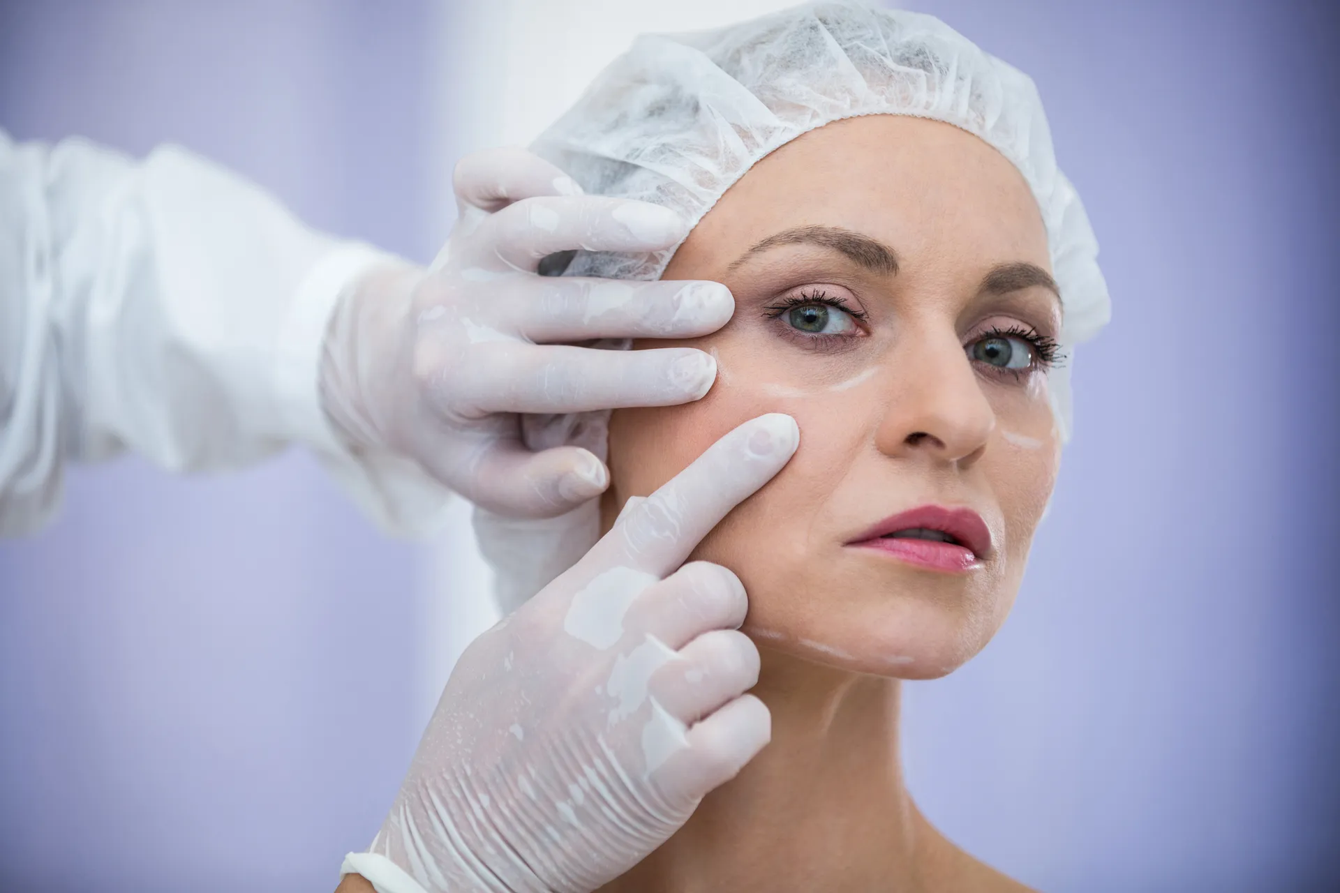 Consulta médica para tratamiento de hiperhidrosis en Zapopan