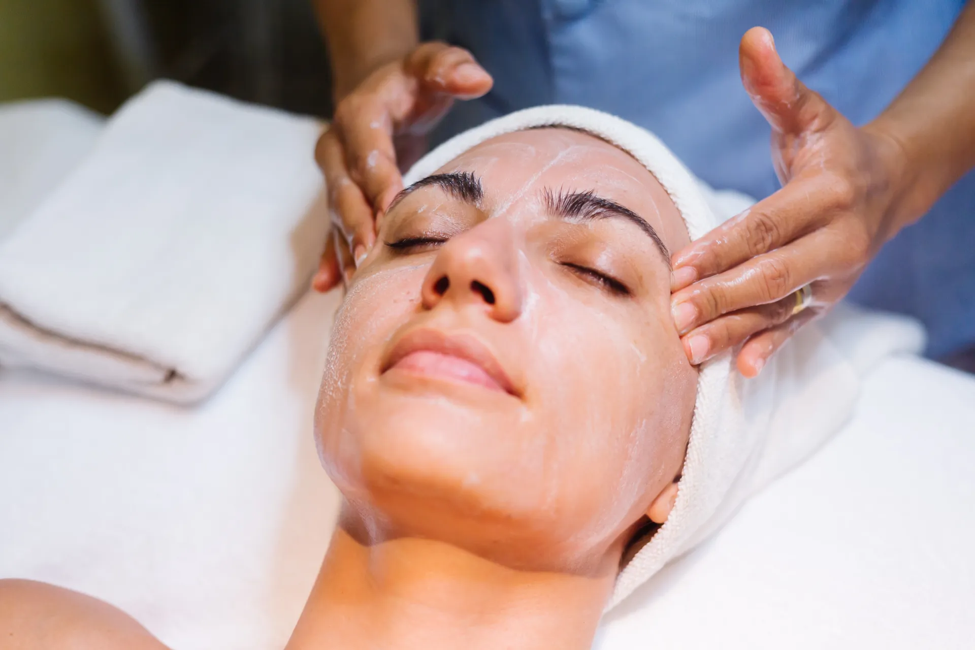Peeling químico para rejuvenecimiento facial en Zapopan